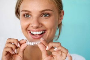 orthodontic retainer