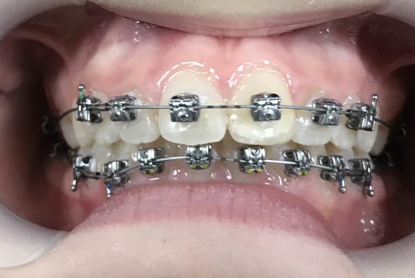 dental orthodontics