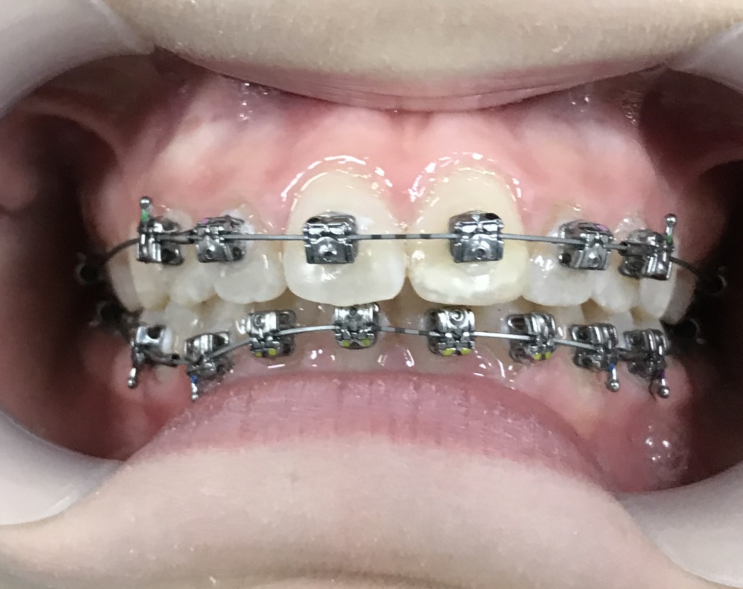 Dental Orthodontics