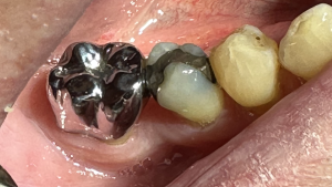 white gold crown