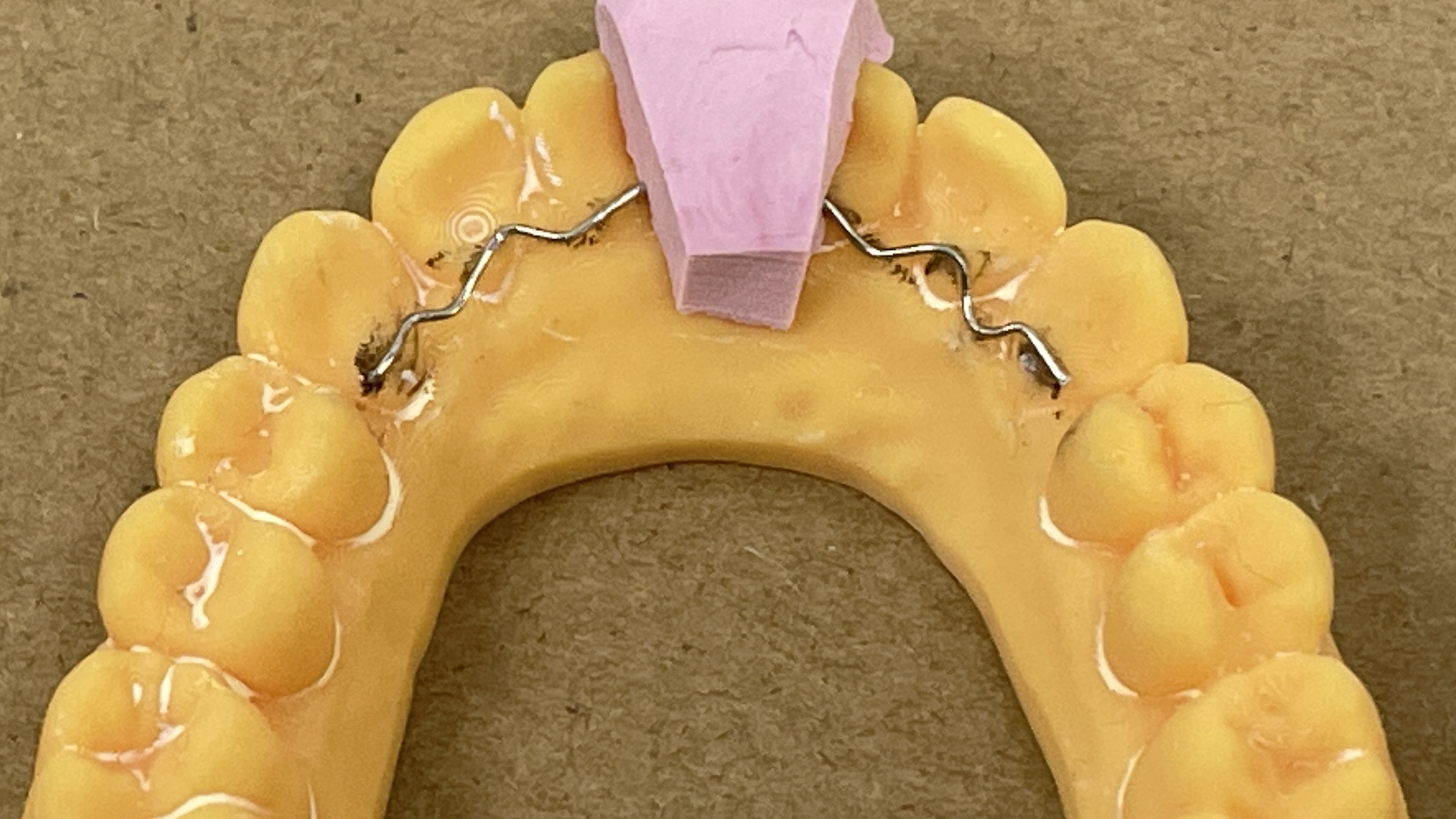 Orthodontic Retainers